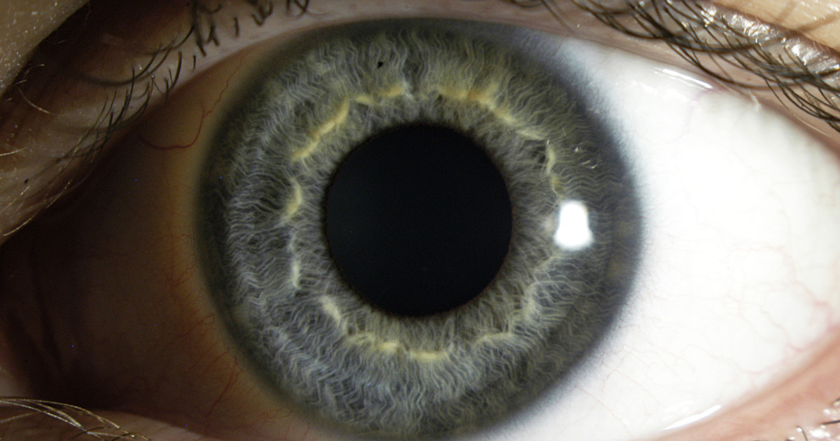What Is the Connection Between Corneal Thickness and